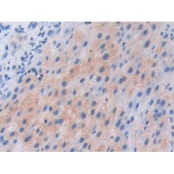 Phosphoinositide-3-Kinase Catalytic Beta Polypeptide (PIK3Cb) Antibody