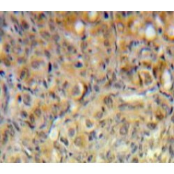 Phosphoinositide-3-Kinase Class-2-Alpha Polypeptide (PIK3C2a) Antibody