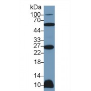 Western blot analysis of Rat Heart lysate, using Human TNFSF12 Antibody (2 µg/ml) and HRP-conjugated Goat Anti-Rabbit antibody (<a href="https://www.abbexa.com/index.php?route=product/search&amp;search=abx400043" target="_blank">abx400043</a>, 0.2 µg/ml).