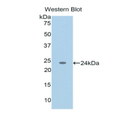 Tumor Necrosis Factor Ligand Superfamily, Member 12 (TNFSF12) Antibody