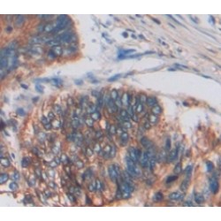 Tumor Necrosis Factor Ligand Superfamily, Member 12 (TNFSF12) Antibody