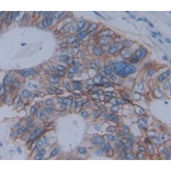 Tumor Necrosis Factor Ligand Superfamily, Member 12 (TNFSF12) Antibody