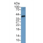 abx104626