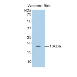 Tumor Necrosis Factor Ligand Superfamily Member 13 / CD256 (TNFSF13) Antibody