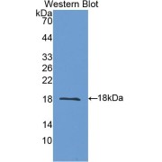 Western blot analysis of the recombinant protein.