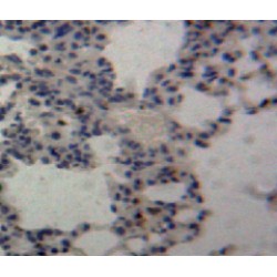 Tumor Necrosis Factor Ligand Superfamily Member 13 / CD256 (TNFSF13) Antibody