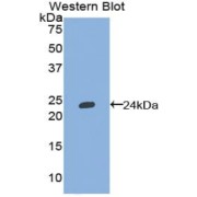 Western blot analysis of the recombinant protein.