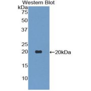abx104630
