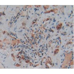 Tumor Necrosis Factor Ligand Superfamily Member 14 / LIGHT (TNFSF14) Antibody