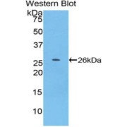 abx104632
