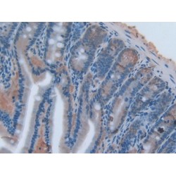 Tumor Necrosis Factor Ligand Superfamily Member 14 / LIGHT (TNFSF14) Antibody