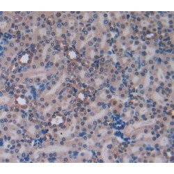 Tumor Necrosis Factor Ligand Superfamily Member 14 / LIGHT (TNFSF14) Antibody