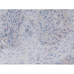Natural Killer Cells Antigen CD94 (KLRD1) Antibody