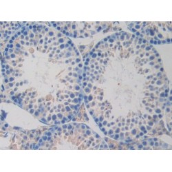 Oxidized Low Density Lipoprotein Receptor 1 (OLR1) Antibody