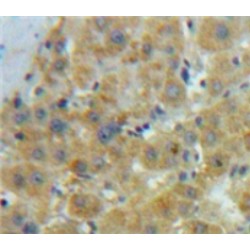 Oxidized Low Density Lipoprotein Receptor 1 (OLR1) Antibody