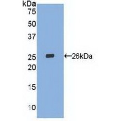 Oxidized Low Density Lipoprotein Receptor 1 (OLR1) Antibody