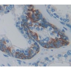 O-Fucosylpeptide-3-Beta-N-Acetylglucosaminyltransferase (RFNG) Antibody