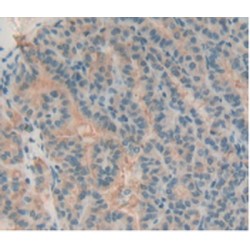 T-Cell Immunoreceptor with Ig and ITIM Domains (TIGIT) Antibody