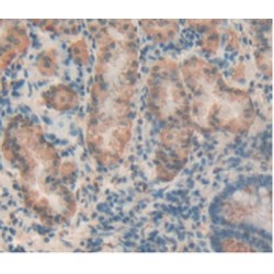 T-Cell Immunoreceptor with Ig and ITIM Domains (TIGIT) Antibody