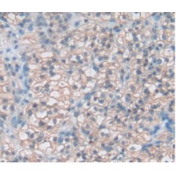 T-Cell Immunoreceptor with Ig and ITIM Domains (TIGIT) Antibody