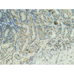Tumor Necrosis Factor Receptor Superfamily Member 9 / CD137 (TNFRSF9) Antibody
