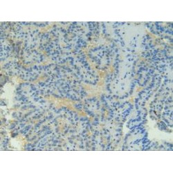 Tumor Necrosis Factor Receptor Superfamily Member 9 / CD137 (TNFRSF9) Antibody