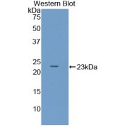 Western blot analysis of the recombinant protein.