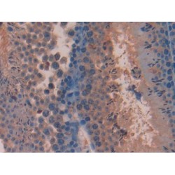 Pituitary Adenylate Cyclase-Activating Polypeptide / PACAP (ADCYAP1) Antibody