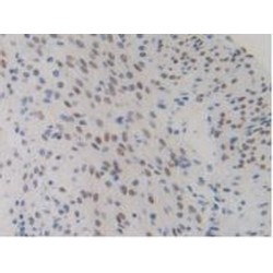 Non-Histone Chromosomal Protein HMG-14 (HMGN1) Antibody
