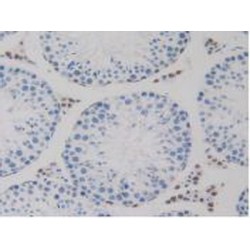 Non-Histone Chromosomal Protein HMG-14 (HMGN1) Antibody
