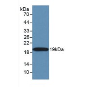 Western blot analysis of recombinant Human TNFSF10.