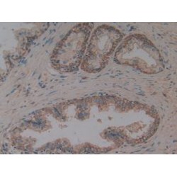 Tumor Necrosis Factor Ligand Superfamily Member 10 (TNFSF10) Antibody