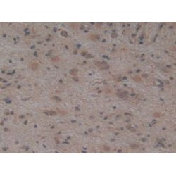 Tumor Necrosis Factor Ligand Superfamily Member 10 (TNFSF10) Antibody
