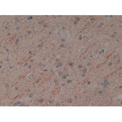 Tumor Necrosis Factor Ligand Superfamily Member 10 (TNFSF10) Antibody