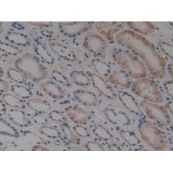 Tumor Necrosis Factor Ligand Superfamily Member 10 (TNFSF10) Antibody
