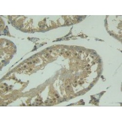 Tumor Necrosis Factor Ligand Superfamily Member 10 (TNFSF10) Antibody