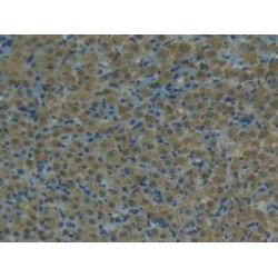Tumor Necrosis Factor Ligand Superfamily Member 10 (TNFSF10) Antibody