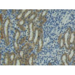 Tumor Necrosis Factor Ligand Superfamily Member 10 (TNFSF10) Antibody