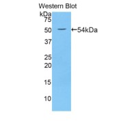 Western blot analysis of recombinant Mouse WNT10A Protein (with N-terminal His and GST tags).