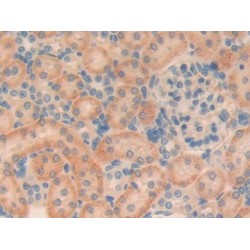 Transforming Growth Factor Beta 1 Induced Transcript 1 (TGFb1I1) Antibody