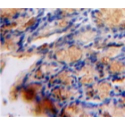 Transforming Growth Factor Beta 1 Induced Transcript 1 (TGFb1I1) Antibody