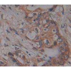 Tumor Necrosis Factor Receptor Superfamily, Member 21 (TNFRSF21) Antibody