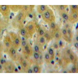 Pleckstrin Homology Domain Containing Family A, Member 1 (PLEKHA1) Antibody