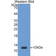 Western blot analysis of the recombinant protein.