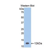 Western blot analysis of the recombinant protein.