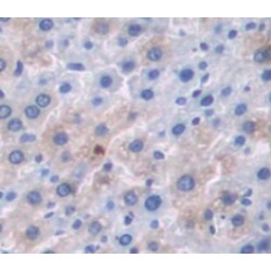 Serpin A12 (SERPINA12) Antibody