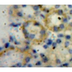 A Disintegrin And Metalloproteinase With Thrombospondin 1 (ADAMTS1) Antibody