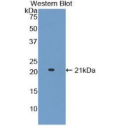 Western blot analysis of recombinant Mouse ADAMTS2.