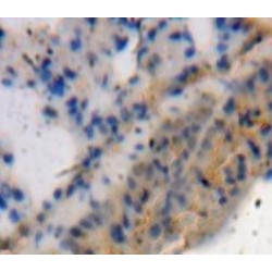 A Disintegrin And Metalloproteinase With Thrombospondin 4 (ADAMTS4) Antibody