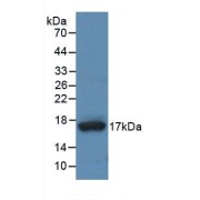 Western blot analysis of recombinant Human ADAMTS4.